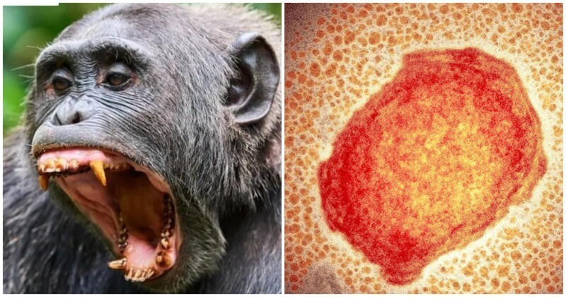 И снова здравствуйте: будет ли пандемия обезьяньей оспы? (4 фото)