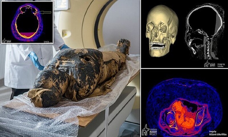 Ученые обнаружили рак у беременной египетской мумии (8 фото + 1 видео)