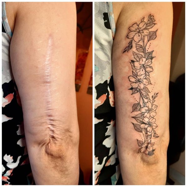 Люди, которые решили не прятать свои шрамы, а обыграть их с помощью татуировок (15 фото)