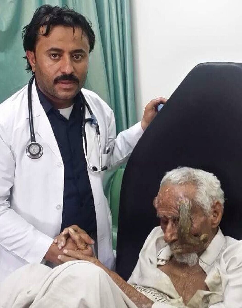 A 140 Year Old Yemeni Man Died After Having His Horns Removed They Say