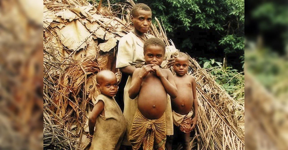 Why do African children often have such big bellies? (5 photos) » Nevsedoma
