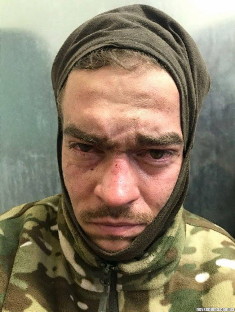 Подборка видео с пленными и убитыми в Украине. Выпуск 66